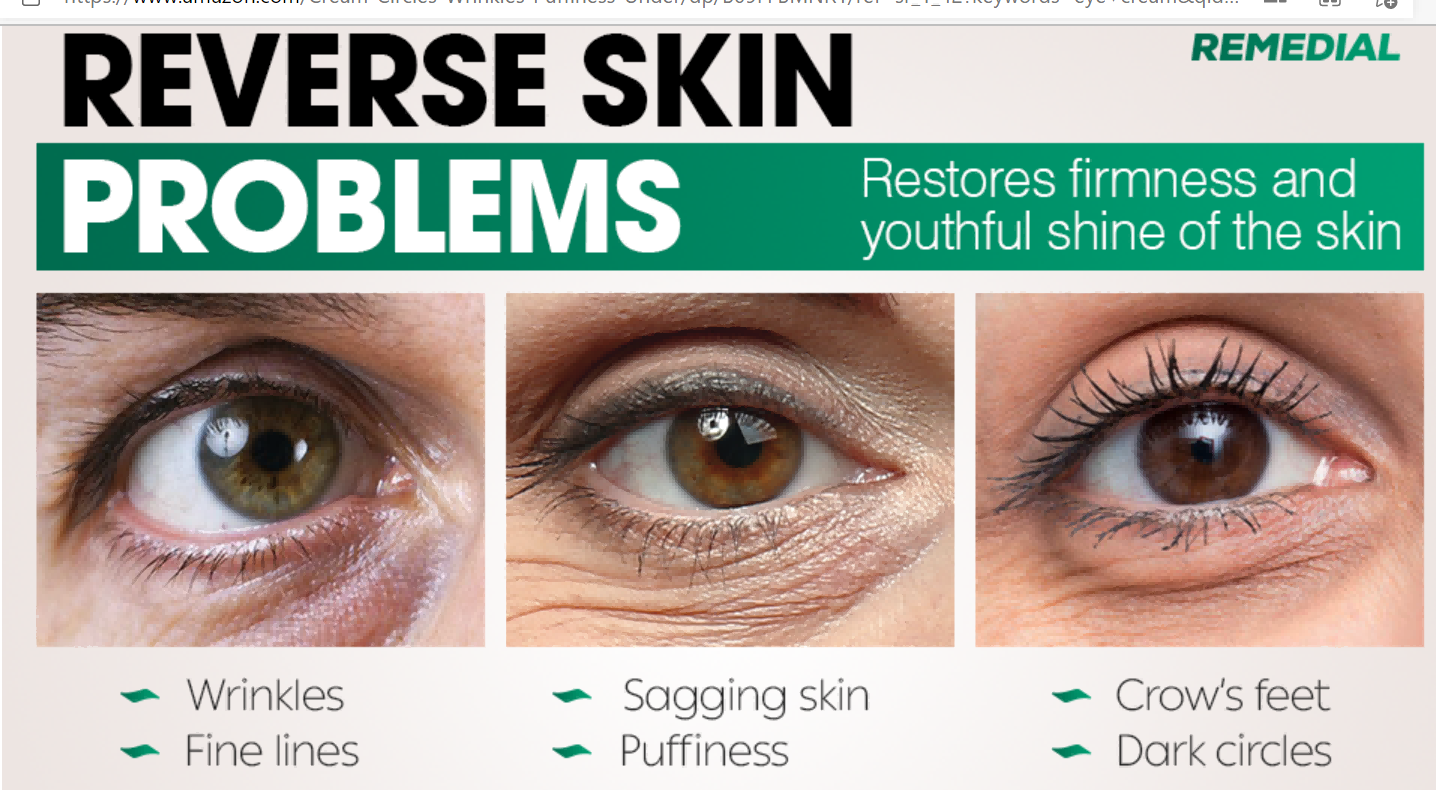 eye cream-4 eye cream-4